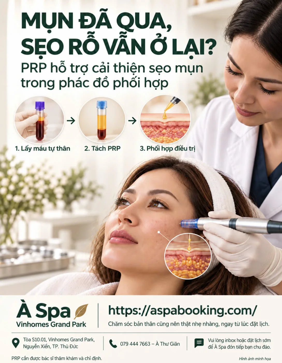 MỤN ĐÃ HẾT, NHƯNG SẸO RỖ VẪN Ở LẠI ?